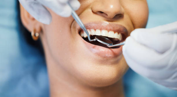 Best Emergency Dental Surgery in Haslet, TX